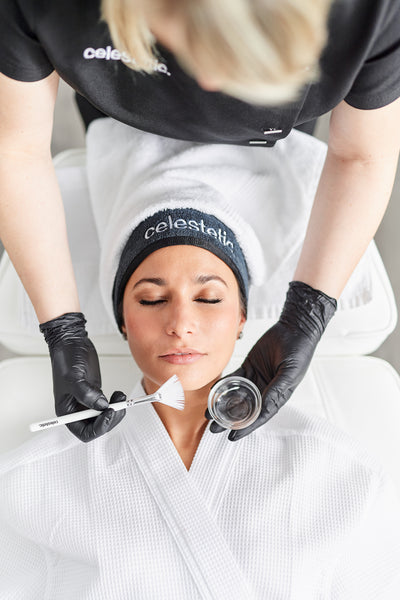 FORMATION PEELING CHIMIQUE